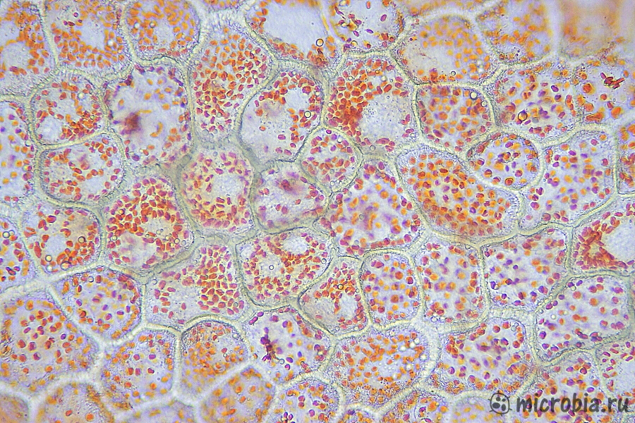 Хромапласты под микроскопом 100x Chromoplasts under microscope