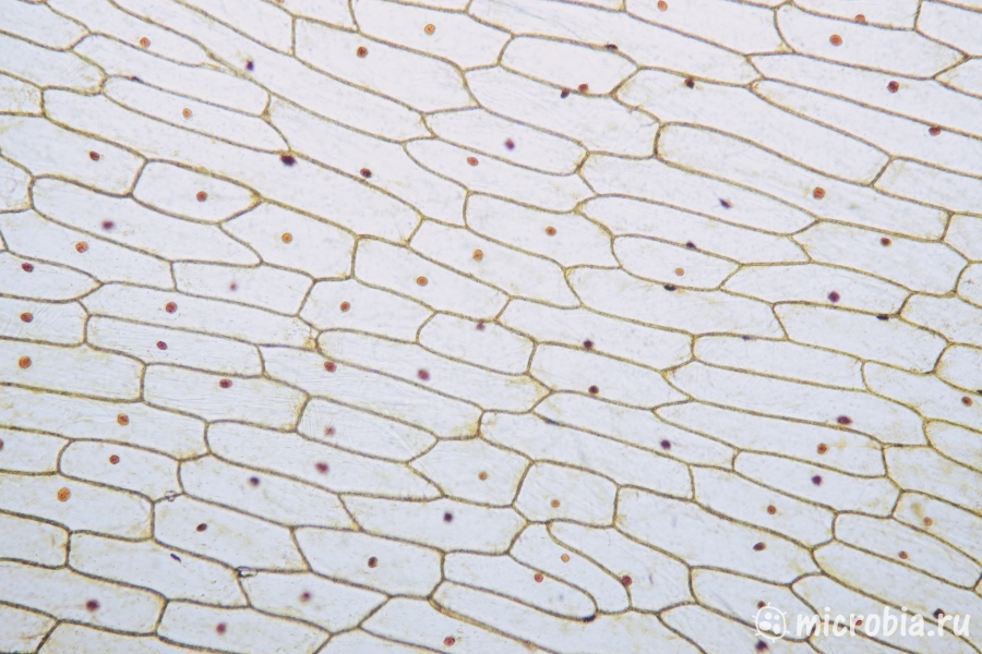 клетки лука под микроскопом окраска йодом увеличение 100x 