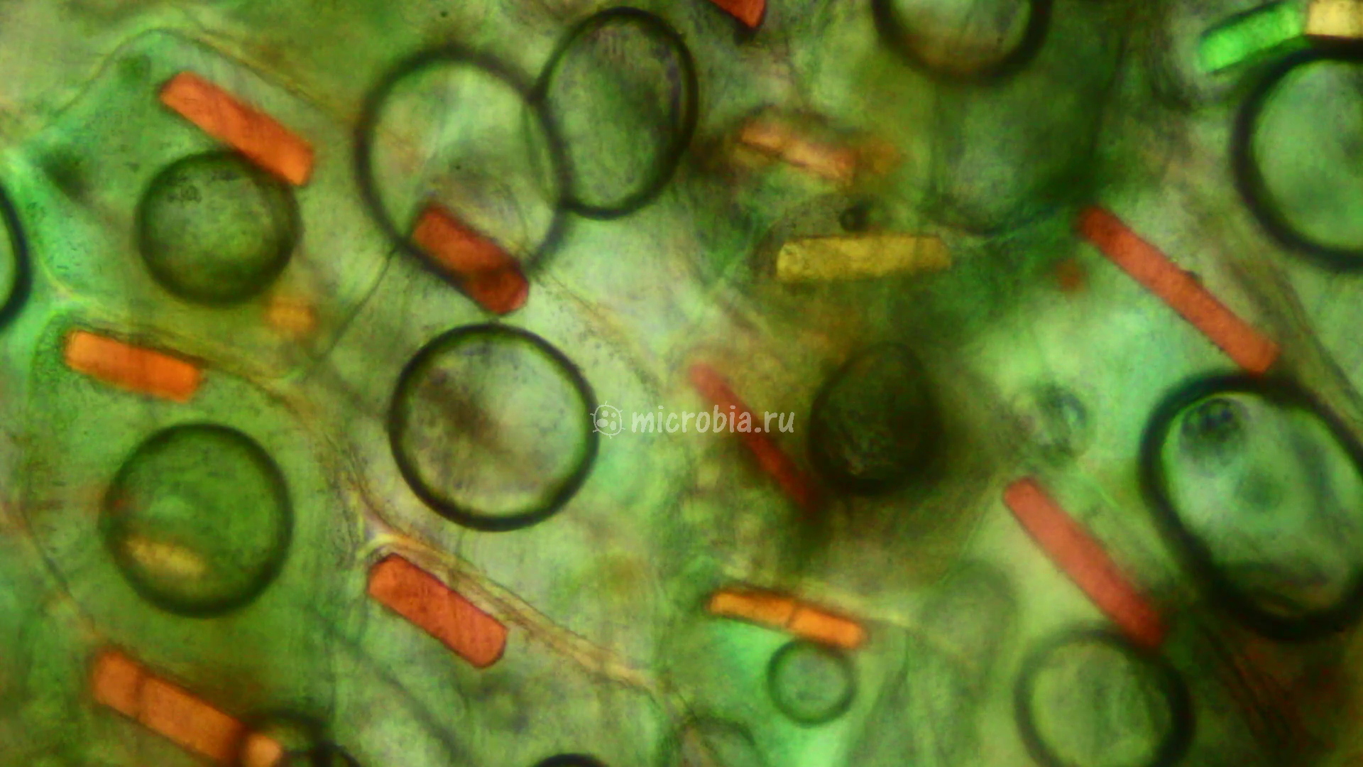 кристаллы в клетках шелухи лука под микроскопом в поляризованном свете