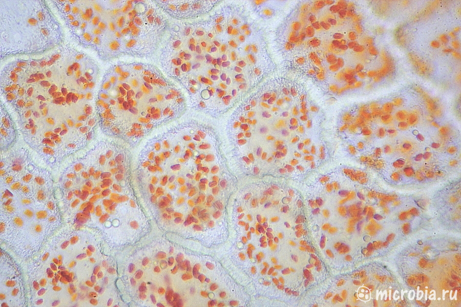 Хромопласты под микроскопом 400x Chromoplasts under microscope