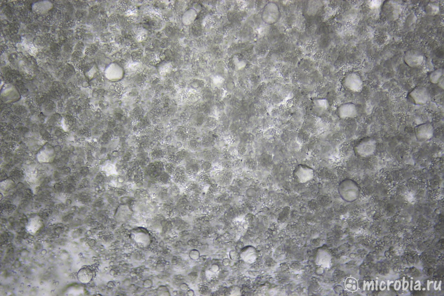 клетки авокадо без окраски под микроскопом с увеличением 100x 