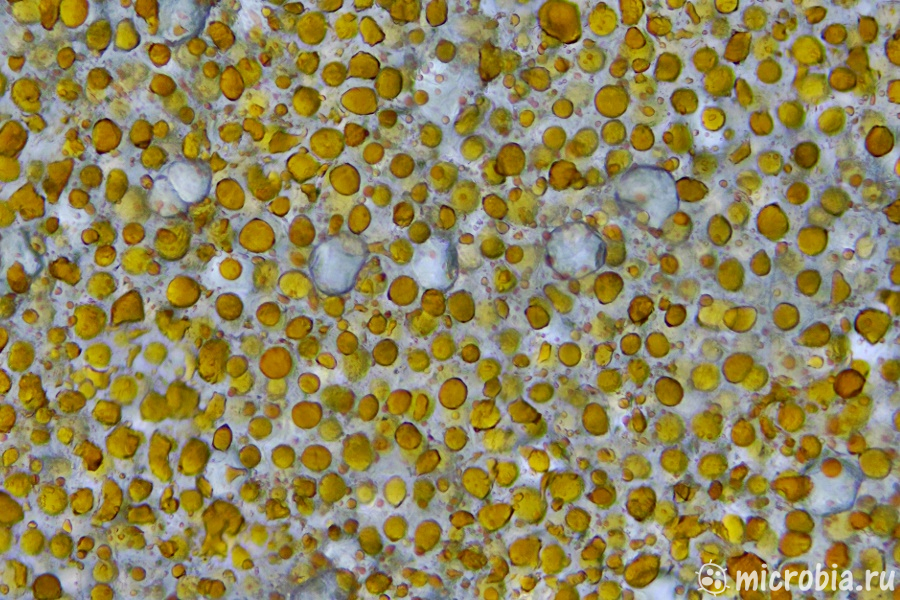 клетки авокадо окраска суданом под микроскопом 100x avocado cells under microscope sudan stain