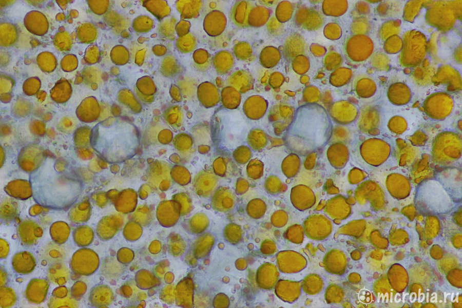 авокадо под микроскопом окраска судааном 200x avocado cells sudan stain