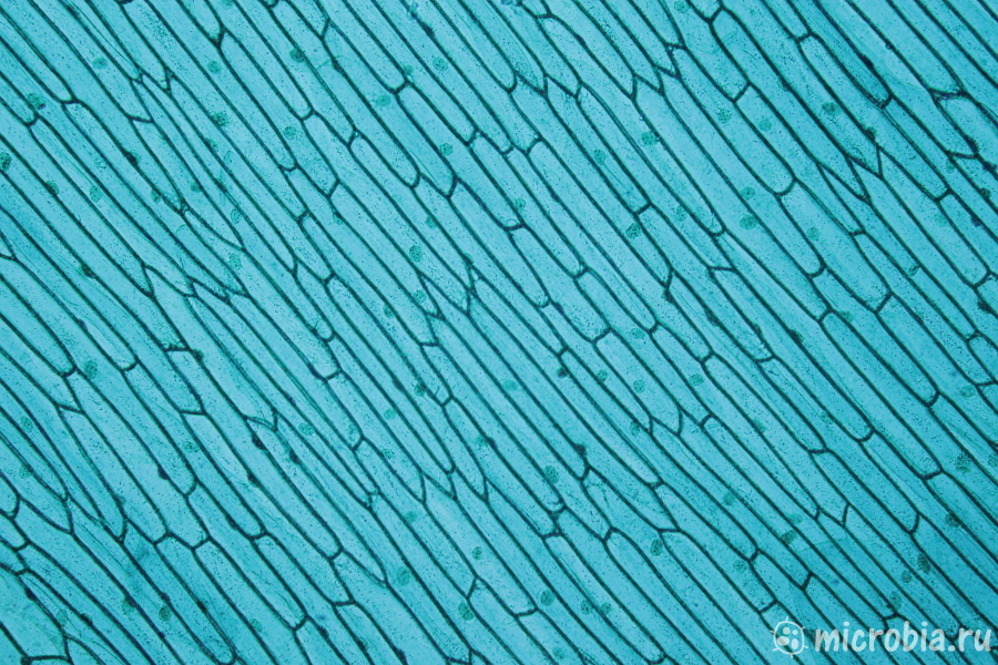летки лука под микроскопом зеленка 100x onion cells under microscope brilliant green
