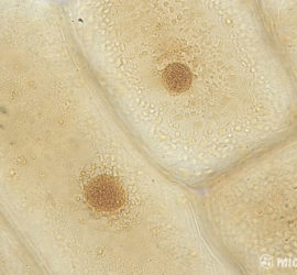 клетки лука под микроскопом окраска йодом 600x
