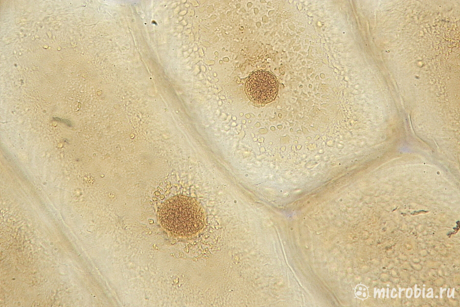 клетки лука под микроскопом йод увеличение 600x 