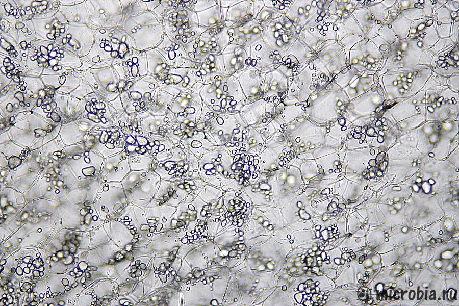 Лейкопласты (амилопласты) с крахмалом в картофеле 100x Leucoplasts amyloplasts in potato under microscope