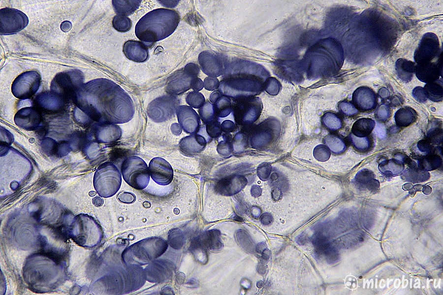 Лейкопласты (амилопласты) под микроскопом в картофеле, 400x окраска йодом