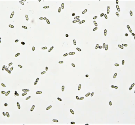Бактерии под микроскопом / Macromonas bacteria