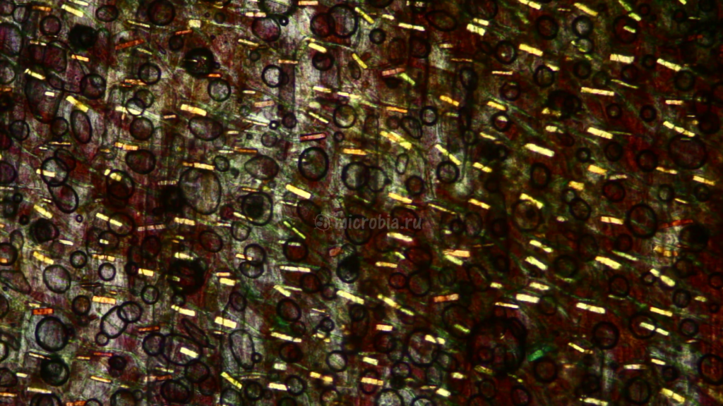 кристаллы в клетках шелухи лука под микроскопом в поляризованном свете