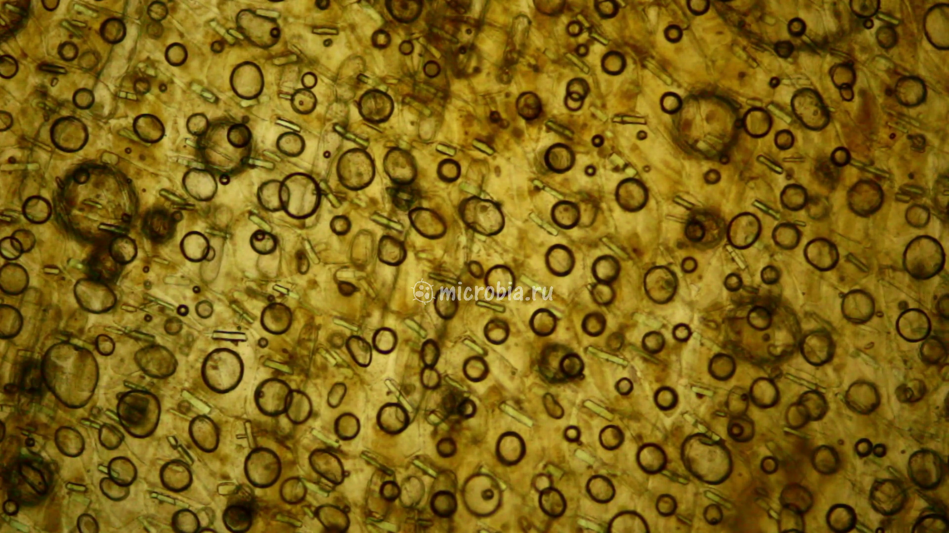 кристаллы в клетках шелухи лука под микроскопом